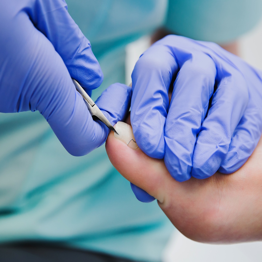 Hygienic,Pedicure,Procedure.,Pedicurist,Treats,Client's,Nails,With,Tweezers.